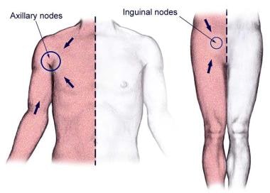 The body quadrants of superficial lymph drainage. 