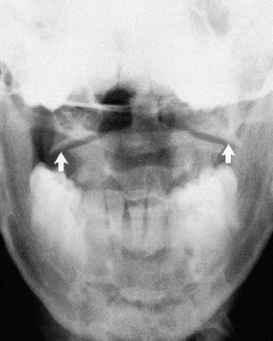 Xray Cock In Mouth Picture 114