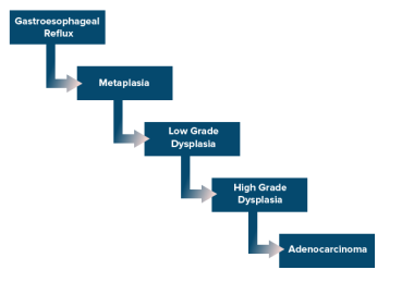 Esophageal cancer. Cascade of events that lead fro