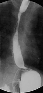 This postoperative contrast-enhanced radiograph re