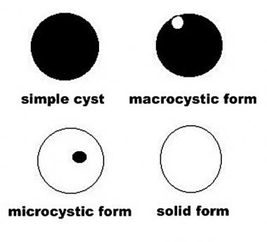 Diagram illustrates the cystic forms. 