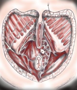 Female perineal anatomy. The urogenital diaphragm 
