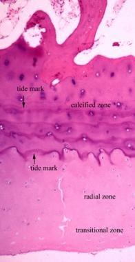 The articular cartilage can be divided into 3 zone