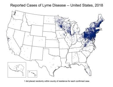 Still s disease emedicine diverticulitis