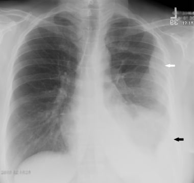 This 63-year-old woman presented with chest pain. 