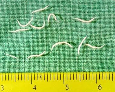 Adult female worms of Enterobius vermicularis coll