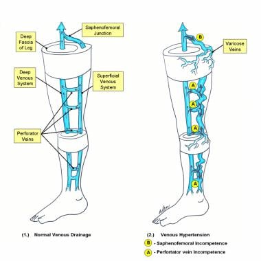 Schematic diagram of deep and superficial venous s