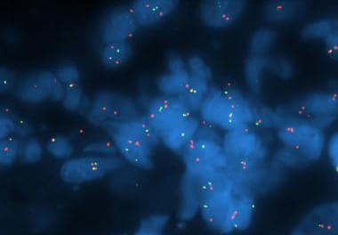 Pathology of Embryonal Tumors. Fluorescence in sit