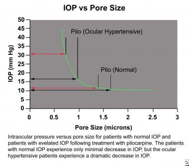 Intraocular pressure versus pore size for patients