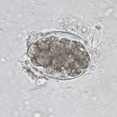 Hookworm egg in an unstained wet mount at 400x mag