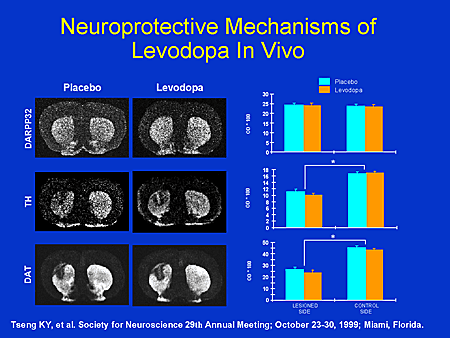 Levodopa Toxicity