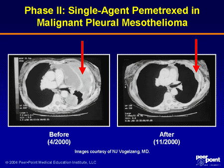 prototipo coche electrico español