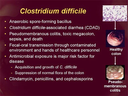 What is a Clostridium difficile infection?