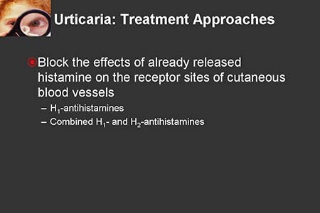 Desloratadine Pediatric Dosing