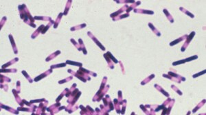 A Pill for C difficile Works by Increasing Microbiome Diversity