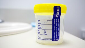 Pre-op Urine Screening: Changing Our Culture