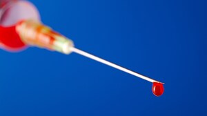 CTC-guided Therapy Beats Physician Choice in Met Breast Cancer