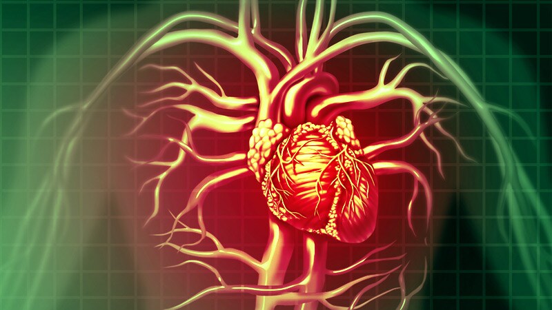 iFR as Safe and Effective as FFR to Guide PCI at 5 Years