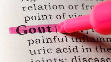 SGLT2 in Patients With Type 2 Diabetes Lowers Risk of Gout 