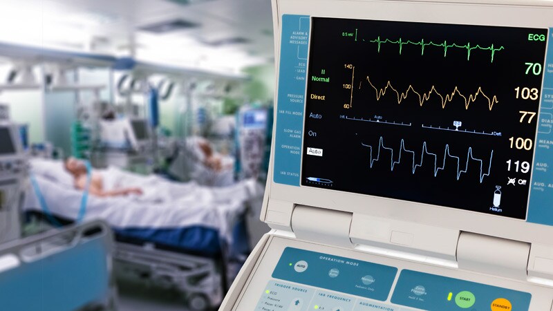 Intensive BP Reduction After Stroke Recanalization Harmful