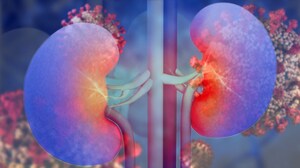 ACEI, ARBs in COVID-19: Be Aware of Acute Kidney Injury