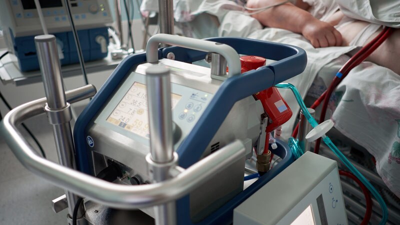 ECMO Signal of Benefit for Cardiogenic Shock After MI