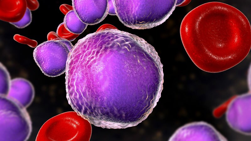 High-Dose MTX Does Not Reduce CNS Relapse in Pediatric ALL