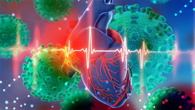NACMI: Clear Benefit With PCI in STEMI COVID-19 Patients
