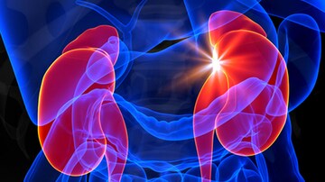 Mixing BP Meds With NSAID May Be 'Triple Whammy' for Kidneys