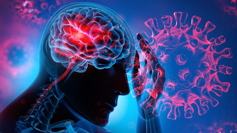 The Drastic Effects of COVID-19 on Stroke Services