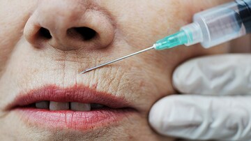 Ophthalmologist Who Developed Medical Botox Dies at 89