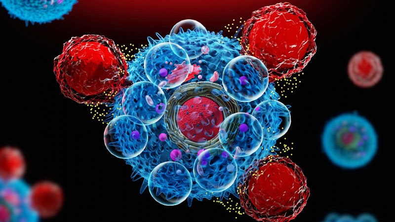 First Data for CAR T-cell Therapy in Follicular Lymphoma