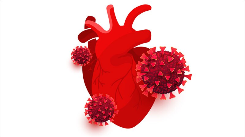 Heart Disease Deaths Spiked During COVID After 10-Year Decline
