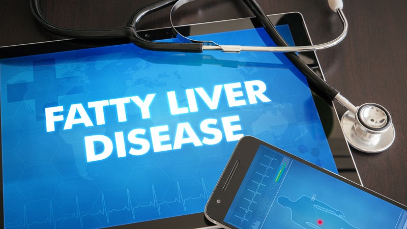 ADA: Screen All With Type 2 Diabetes for Fatty Liver Disease