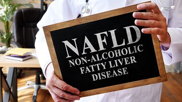 First Fatty Liver Guidelines for Endocrinology, Primary Care	