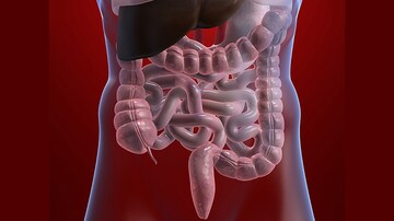 TNF Blockers Beat Newer Biologics in Crohn's Disease