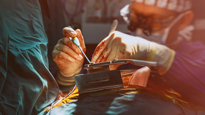 SURTAVI at 5 Years Reinforces TAVR but Was It Long-term Enough?