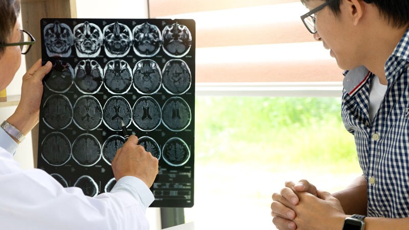 Fewer Strokes on Myosin Activator in HFrEF: GALACTIC-HF