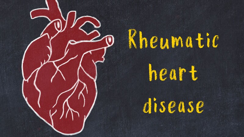 Penicillin Slows Latent Rheumatic Heart Disease Progression