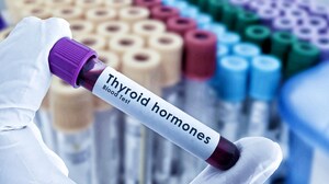 A Thyroid Antibody Primer in Five Quick Cases