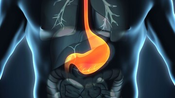 Hemostatic Powder Noninferior in Nonvariceal Upper GI Bleeds