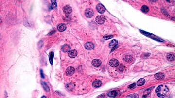 Stem Cell Transplant to Generate Testosterone for Hypogonadism?