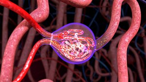 Avacopan Shows Efficacy Signal for Rare Kidney Disease, C3G 