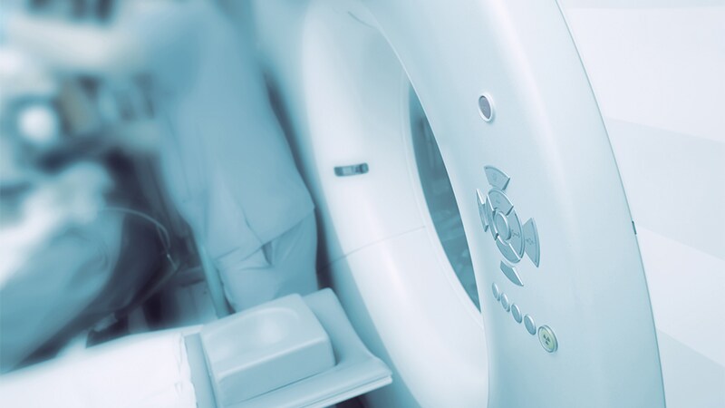 Calcium Scores May Predict Sudden-Death Risk in Preclinical CAD