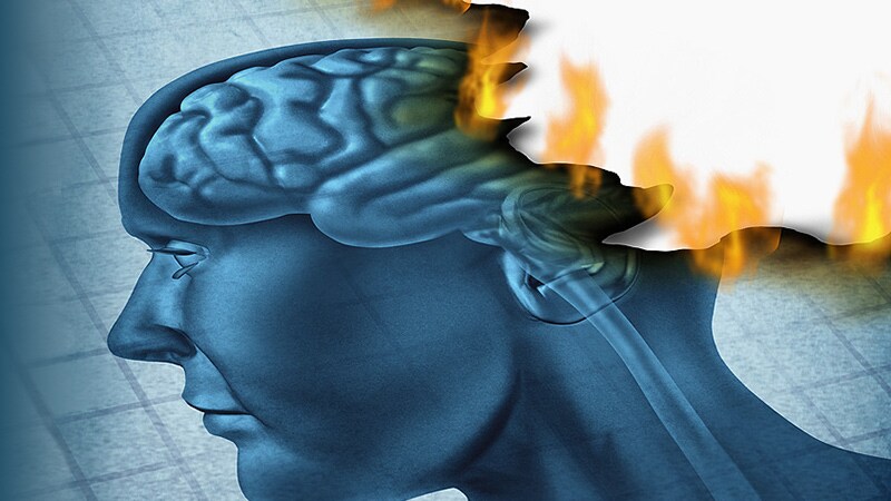 Experimental Drug May Boost Executive Function in Alzheimer's