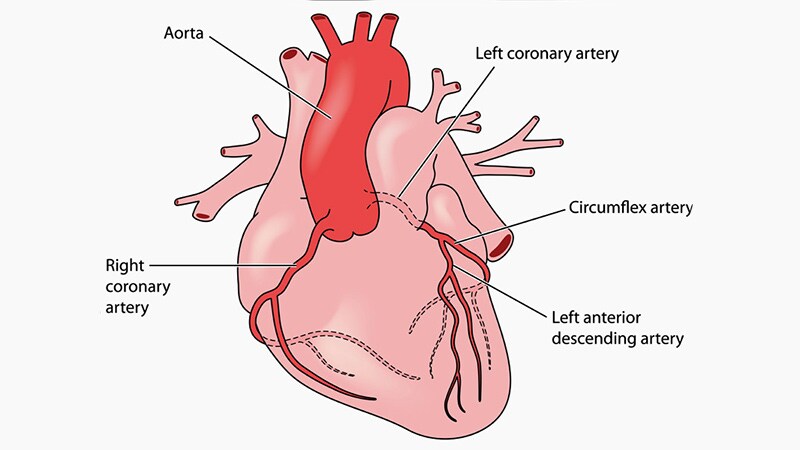 Diltiazem Fails to Improve Vasomotor Dysfunction, Angina in ANOCA 