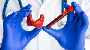 Graves Disease, Thyroid Eye Disease, and COVID-19