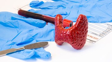 Surgery Shows No Survival, Morbidity Benefit for Mild Hyperparathyroidism