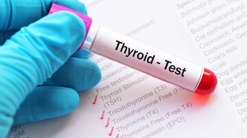 Undertreated Hypothyroidism May Worsen Hospital Outcomes 