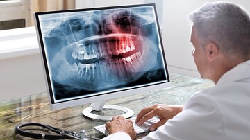 Grit Your Teeth for a Lesser-Known Complication of Diabetes